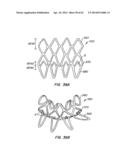 LOW PROFILE HEART VALVE AND DELIVERY SYSTEM diagram and image