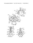 LOW PROFILE HEART VALVE AND DELIVERY SYSTEM diagram and image