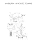 PATIENT POSITIONING DEVICE FOR STEREOTACTIC RADIOSURGERY diagram and image