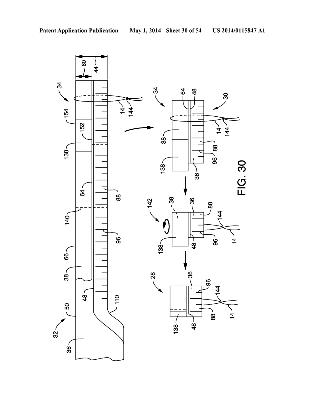 METHOD OF MANUFACTURING TAMPONS BY FORMING A SOFTWIND WITH CONTACT     ELEMENTS - diagram, schematic, and image 31