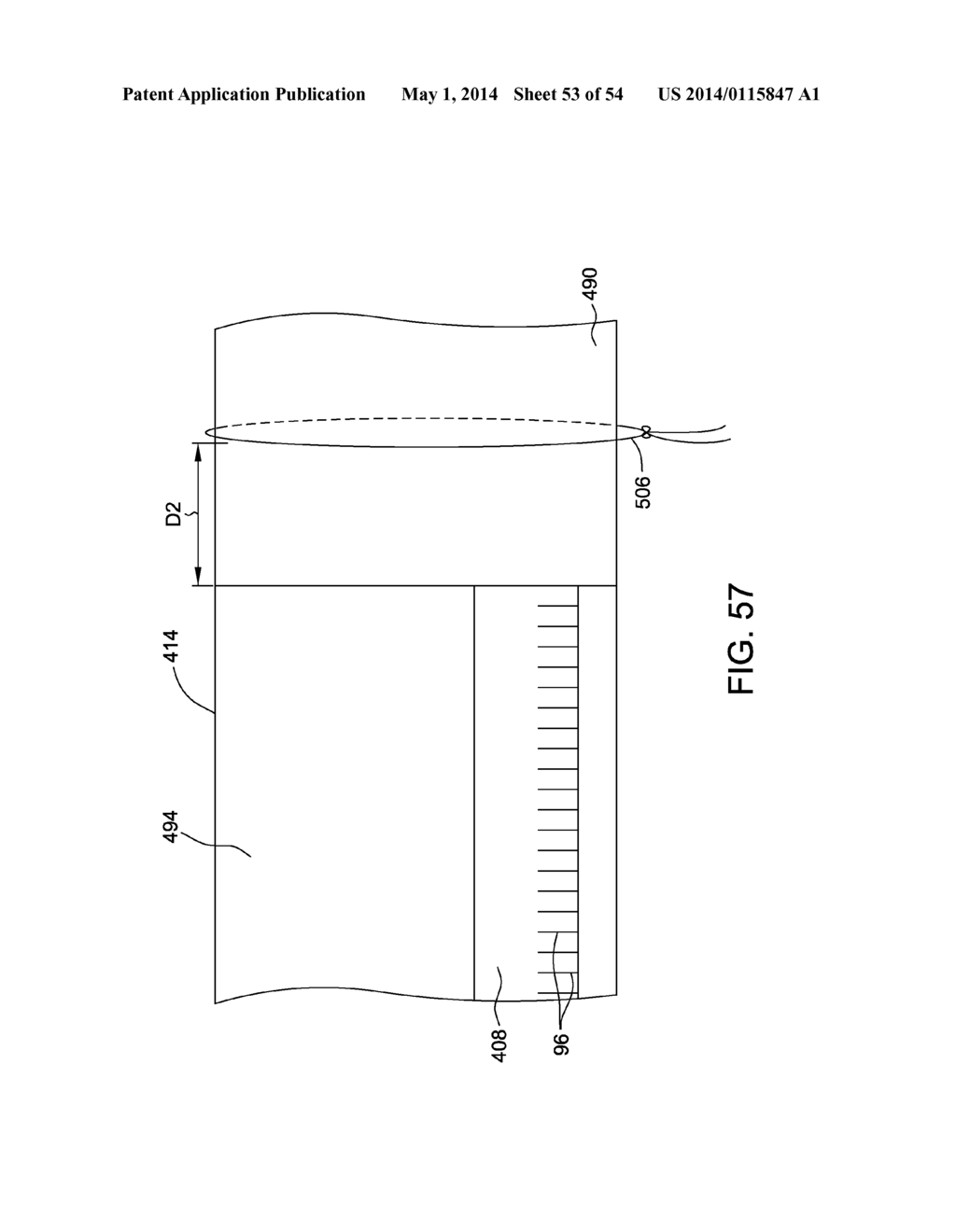 METHOD OF MANUFACTURING TAMPONS BY FORMING A SOFTWIND WITH CONTACT     ELEMENTS - diagram, schematic, and image 54