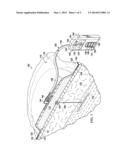 REDUCED-PRESSURE TREATMENT SYSTEMS WITH RESERVOIR CONTROL diagram and image