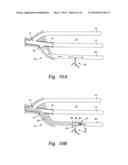 MULTI-LATERAL RE-ENTRY GUIDE AND METHOD OF USE diagram and image