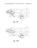 MULTI-LATERAL RE-ENTRY GUIDE AND METHOD OF USE diagram and image