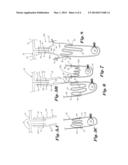 VEHICLE SEAT ASSEMBLY WITH AIR BAG GUIDE SECURED TO AN AIR BAG diagram and image