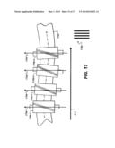 WEB SKEW COMPENSATION IN A PRINTING SYSTEM diagram and image