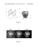 METHOD FOR RECONSTRUCTING IMAGES OF A MULTI-CHANNEL MRI SYSTEM diagram and image