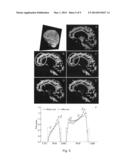 Method for improved estimation of tracer uptake in physiological image     volumes diagram and image