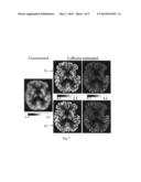 Method for improved estimation of tracer uptake in physiological image     volumes diagram and image