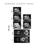 PHOTOSENSITIZING ANTIBODY-FLUOROPHORE CONJUGATES diagram and image