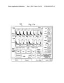 Multipurpose Host System for Invasive Cardiovascular Diagnostic     Measurement Acquisition and Display diagram and image