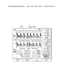 Multipurpose Host System for Invasive Cardiovascular Diagnostic     Measurement Acquisition and Display diagram and image