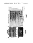 SEIZURE DETECTION DEVICE AND SYSTEMS diagram and image