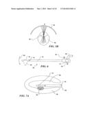 CONTROLLED HIGH EFFICIENCY LESION FORMATION USING HIGH INTENSITY     ULTRASOUND diagram and image