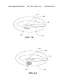 CONTROLLED HIGH EFFICIENCY LESION FORMATION USING HIGH INTENSITY     ULTRASOUND diagram and image