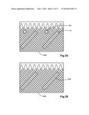 INTRALUMINAL DEVICE AND METHOD WITH ENHANCED ANTI-MIGRATION diagram and image