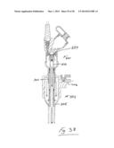 INSUFFLATION SYSTEM diagram and image