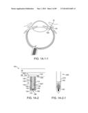 IMPLANTABLE THERAPEUTIC DEVICE diagram and image