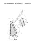 INFLATABLE PROSTHESES AND METHODS OF MAKING SAME diagram and image