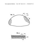 INFLATABLE PROSTHESES AND METHODS OF MAKING SAME diagram and image