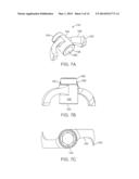 STAND-ALONE INTERBODY FIXATION SYSTEM diagram and image