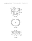 STAND-ALONE INTERBODY FIXATION SYSTEM diagram and image