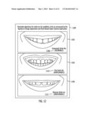 METHOD, SYSTEM, AND COMPUTER PROGRAM PRODUCT TO PERFORM DIGITAL     ORTHODONTICS AT ONE OR MORE SITES diagram and image