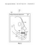 METHOD, SYSTEM, AND COMPUTER PROGRAM PRODUCT TO PERFORM DIGITAL     ORTHODONTICS AT ONE OR MORE SITES diagram and image