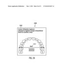 METHOD, SYSTEM, AND COMPUTER PROGRAM PRODUCT TO PERFORM DIGITAL     ORTHODONTICS AT ONE OR MORE SITES diagram and image