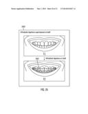 METHOD, SYSTEM, AND COMPUTER PROGRAM PRODUCT TO PERFORM DIGITAL     ORTHODONTICS AT ONE OR MORE SITES diagram and image