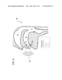 DIGITAL PROCESSOR BASED COMPLEX ACOUSTIC RESONANCE DIGITAL SPEECH ANALYSIS     SYSTEM diagram and image