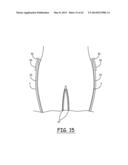 Portable System for Assisting Body Movement diagram and image