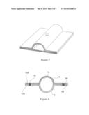 Rigid Disposable Flow Path diagram and image