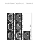 Adaptive and Interactive Assessment of Tissue Properties in MR Imaging diagram and image