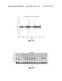 ACOUSTIC MONITORING SYSTEM AND METHODS diagram and image