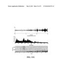 ACOUSTIC MONITORING SYSTEM AND METHODS diagram and image