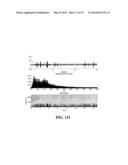 ACOUSTIC MONITORING SYSTEM AND METHODS diagram and image