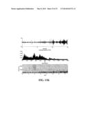 ACOUSTIC MONITORING SYSTEM AND METHODS diagram and image