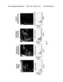 SYSTEMS WITH WORKSTATIONS AND CIRCUITS FOR GENERATING IMAGES OF GLOBAL     INJURY diagram and image