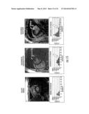 SYSTEMS WITH WORKSTATIONS AND CIRCUITS FOR GENERATING IMAGES OF GLOBAL     INJURY diagram and image