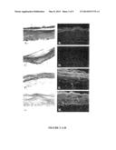 Method and Composition for Skin Grafts diagram and image