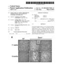 Using GNMT as a Novel Therapeutic or Preventing Agent for Fatty Liver     Related Diseases diagram and image