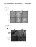 Using GNMT as a Novel Therapeutic or Preventing Agent for Fatty Liver     Related Diseases diagram and image