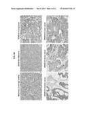 SPANX-B POLYPEPTIDES AND THEIR USE diagram and image