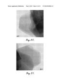 MESOPOROUS ZEOLITE CATALYST SUPPORTS diagram and image