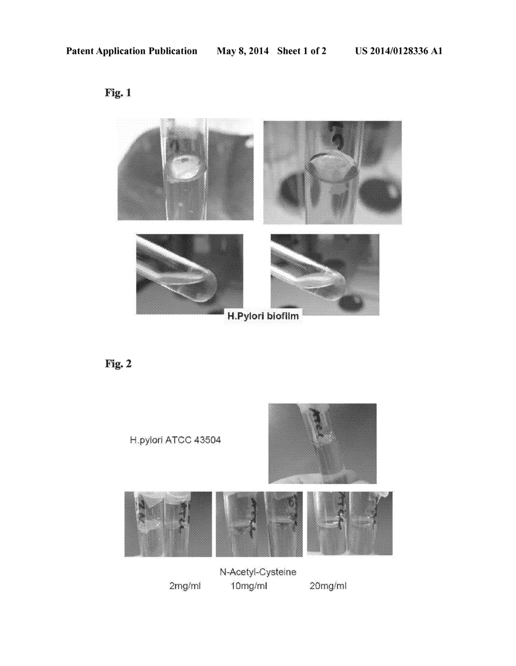 MEDICAL PRODUCTS FOR USE IN CONDITIONS RELATED TO MICROBIAL INFECTIONS IN     THE UPPER AERODIGESTIVE TRACT - diagram, schematic, and image 02