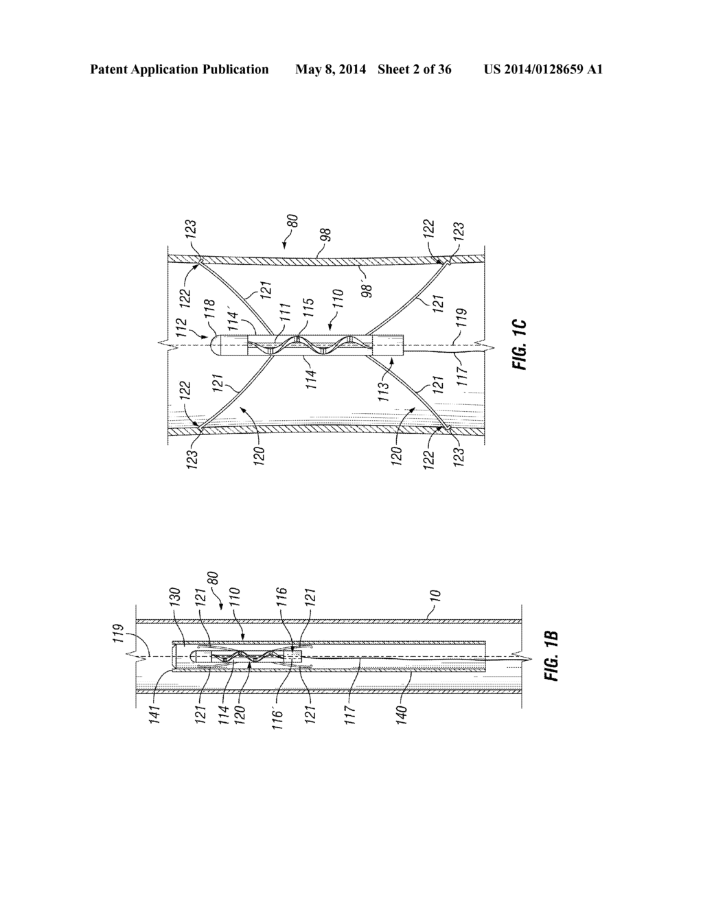 SYSTEMS AND METHODS FOR FLUID FLOWS AND/OR PRESSURES FOR CIRCULATION AND     PERFUSION ENHANCEMENT - diagram, schematic, and image 03