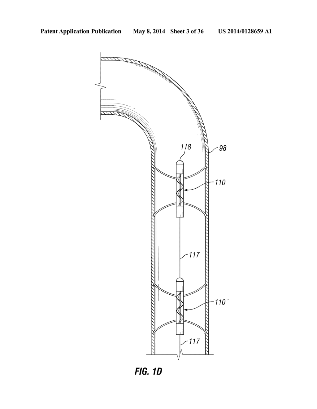 SYSTEMS AND METHODS FOR FLUID FLOWS AND/OR PRESSURES FOR CIRCULATION AND     PERFUSION ENHANCEMENT - diagram, schematic, and image 04