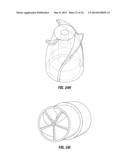 SYSTEMS AND METHODS FOR FLUID FLOWS AND/OR PRESSURES FOR CIRCULATION AND     PERFUSION ENHANCEMENT diagram and image