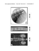 SYSTEMS AND METHODS FOR FLUID FLOWS AND/OR PRESSURES FOR CIRCULATION AND     PERFUSION ENHANCEMENT diagram and image